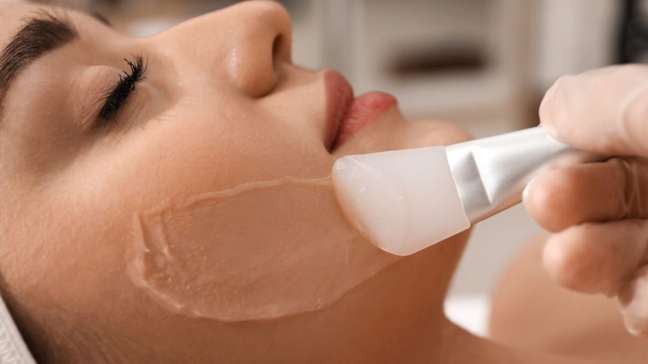Face Peels