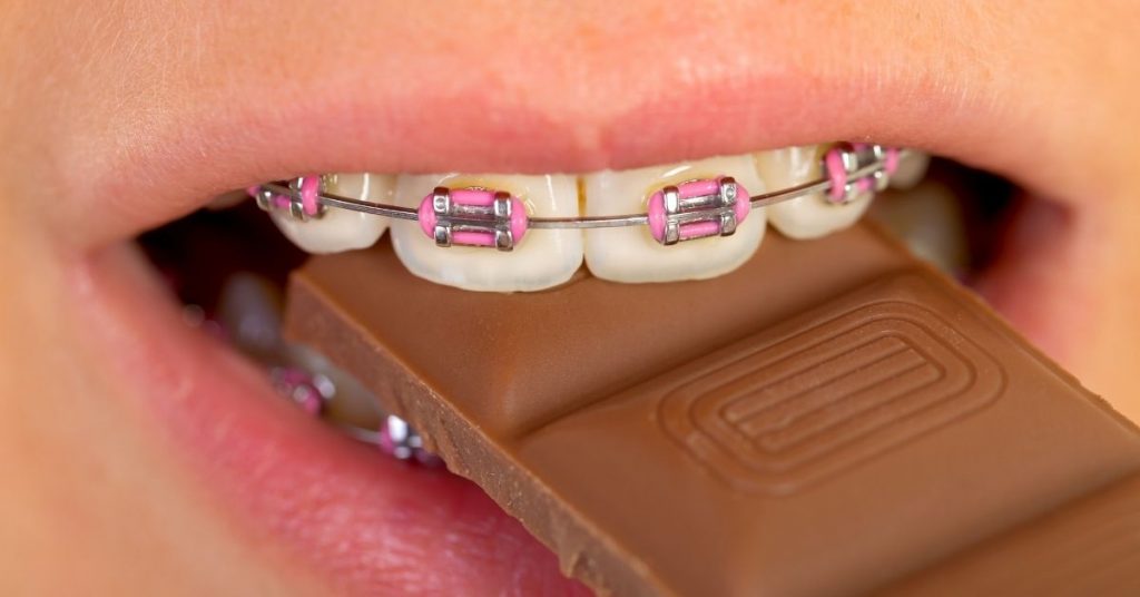 What candy Can You Eat with Braces