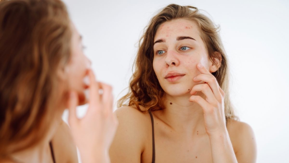 unhealthy skin